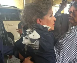 Vídeo: deputada é atingida por explosivo na cabeça durante entrevista
