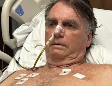 Médico atualiza estado de saúde de Bolsonaro após queda nesta manhã - Imagem