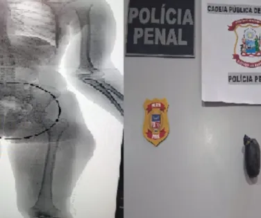 Flagrada no Raio-X: mulher é presa ao entrar em presídio com drogas nas partes íntimas - Imagem