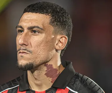 Baralhas vê injustiça em derrota do Vitória para o Flamengo - Imagem