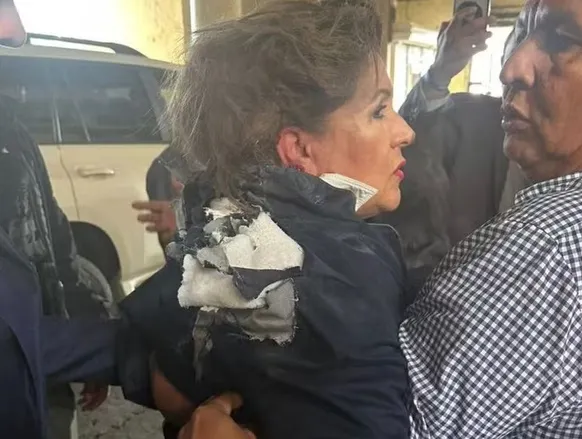 Vídeo: deputada é atingida por explosivo na cabeça durante entrevista - Imagem