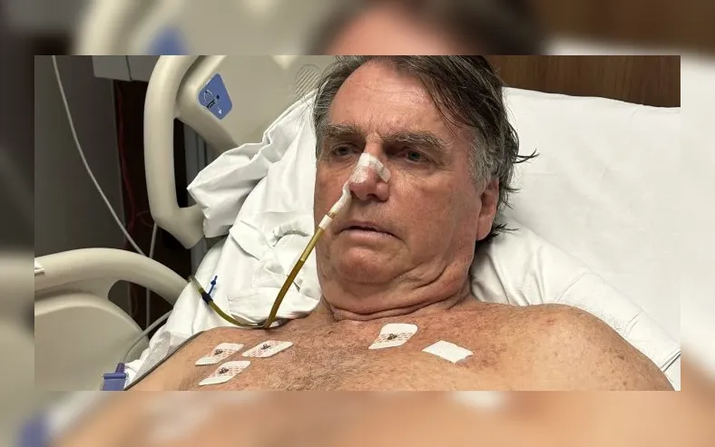Médico atualiza estado de saúde de Bolsonaro após queda nesta manhã - Imagem