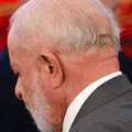 Lula remove câncer de pele; veja os detalhes imagem
