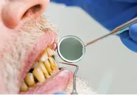 Saiba como a saúde bucal pode influenciar doenças cardíacas