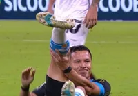 VÍDEO: jogador do Grêmio sofre lesão terrível contra o Vitória imagem