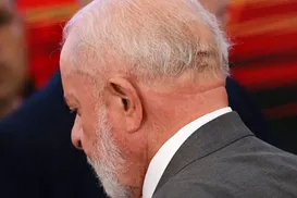 Lula remove câncer de pele; veja os detalhes - Imagem