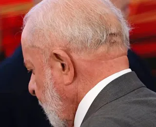 Lula remove câncer de pele; veja os detalhes