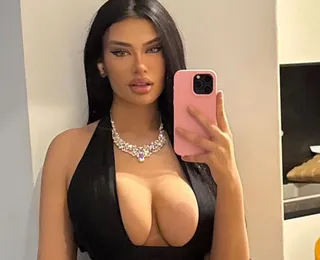 Sósia de Kylie Jenner gasta R$ 500 mil em plásticas: "Não me reconheço"