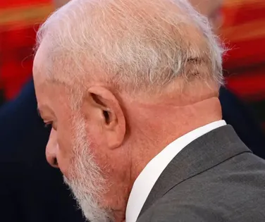 Lula remove câncer de pele; veja os detalhes - Imagem