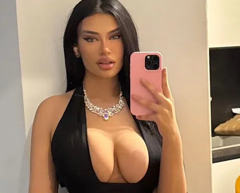 Sósia de Kylie Jenner gasta R$ 500 mil em plásticas: "Não me reconheço" - Imagem