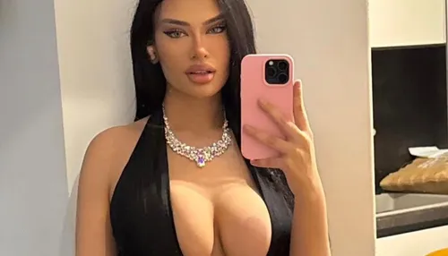 Sósia de Kylie Jenner gasta R$ 500 mil em plásticas: "Não me reconheço"