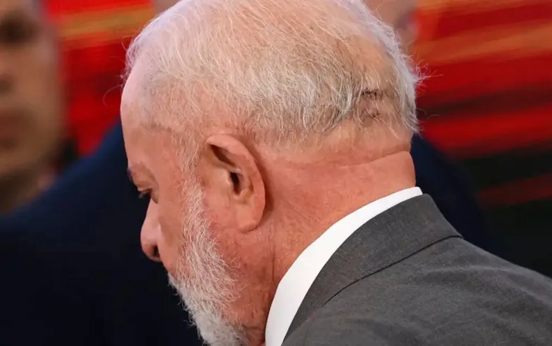 Lula remove câncer de pele; veja os detalhes - Imagem