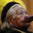 Cacique Raoni volta à UTI com infecção grave e pneumonia