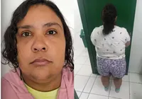 A Órfã? Mulher de 37 anos é presa por fingir ser adolescente de 12 anos para ser adotada