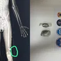 Funcionário é preso ao tentar entrar com drogas em presídio de Salvador imagem