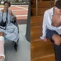 Homem pede indenização de R$ 510 milhões após perder perna em reality imagem