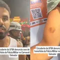 Fratura na mandíbula e cassetete na cabeça: relembre agressões de policiais no carnaval imagem