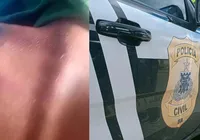 Criança de 8 anos é agredida com cipó pelo professor na Bahia