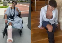 Homem pede indenização de R$ 510 milhões após perder perna em reality