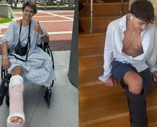 Homem pede indenização de R$ 510 milhões após perder perna em reality