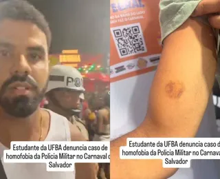 Fratura na mandíbula e cassetete na cabeça: relembre agressões de policias no carnaval