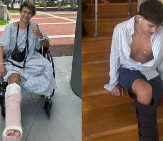 Homem pede indenização de R$ 510 milhões após perder perna em reality