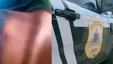 Criança de 8 anos é agredida com cipó pelo professor na Bahia