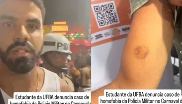 Fratura na mandíbula e cassetete na cabeça: relembre agressões de policiais no carnaval