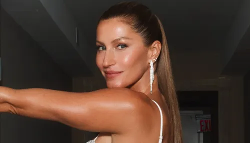 Gisele Bündchen surge com pé machucado e muletas