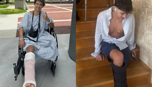 Homem pede indenização de R$ 510 milhões após perder perna em reality