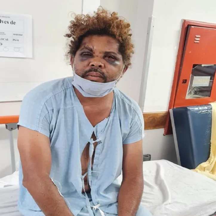 Morador de rua foi hospitalizado