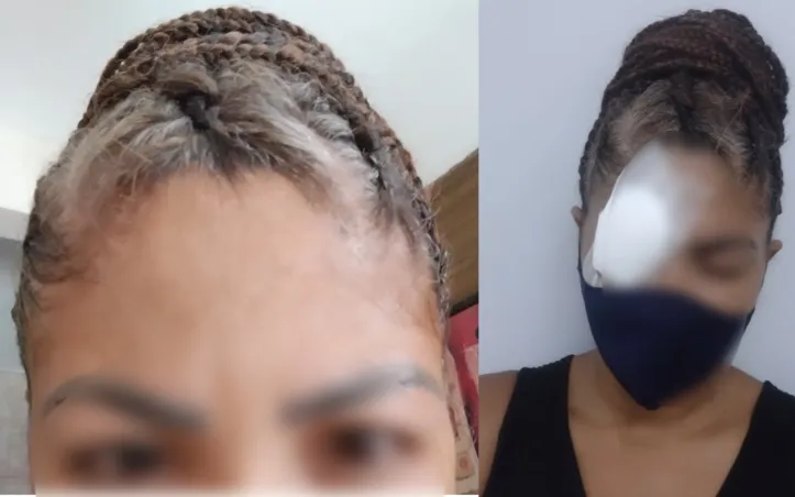 Arielle entrou em contato com água dois dias após usar o produto.