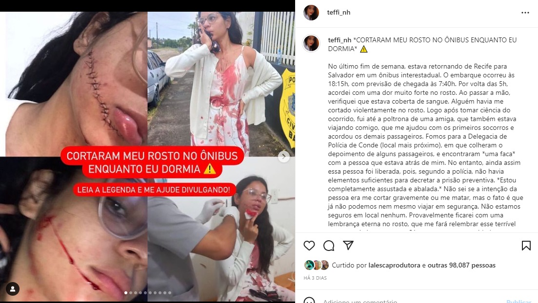 inline_01213405_00 Estudante que teve rosto cortado em ônibus divulga imagens da ação