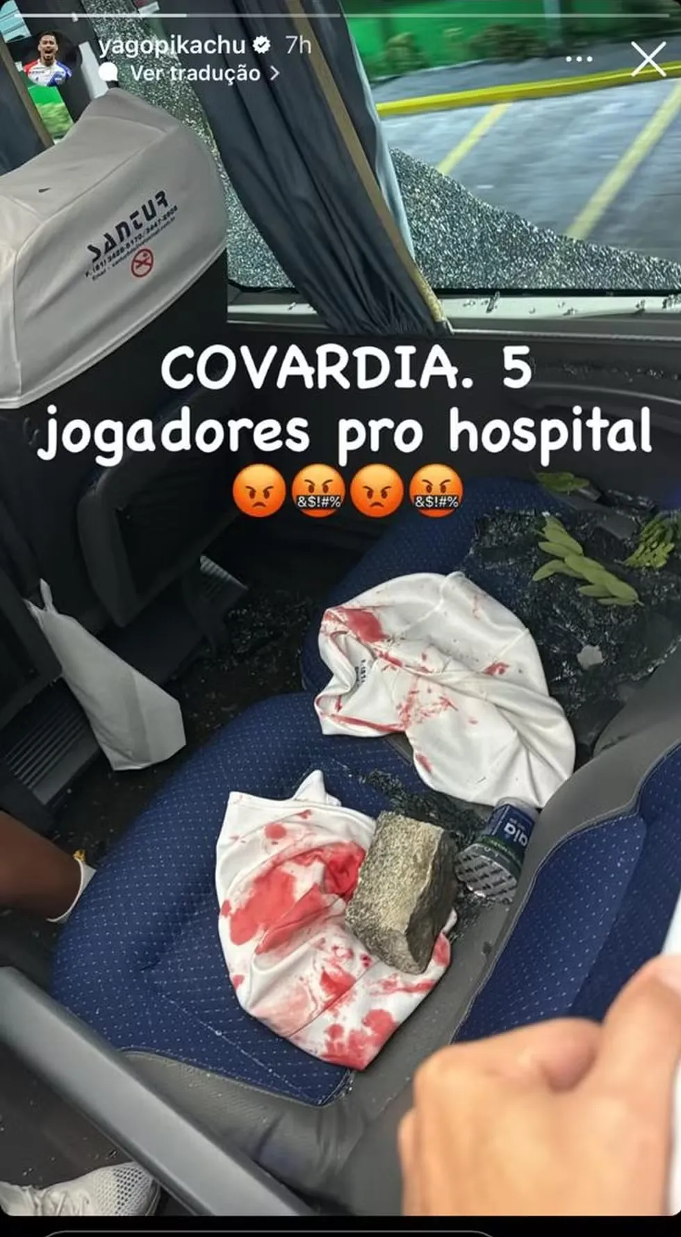 Imagem ilustrativa da imagem Jogadores do Fortaleza se pronunciam após atentado: "São bandidos"