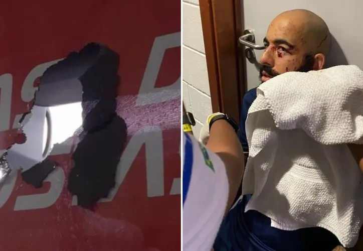 Imagem ilustrativa da imagem Relembre outros casos de agressão envolvendo organizada e jogadores