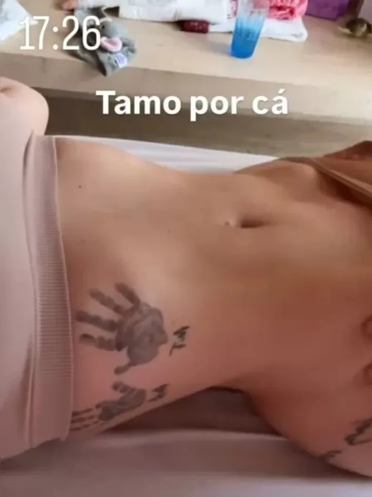 Barriga da famosa após parto