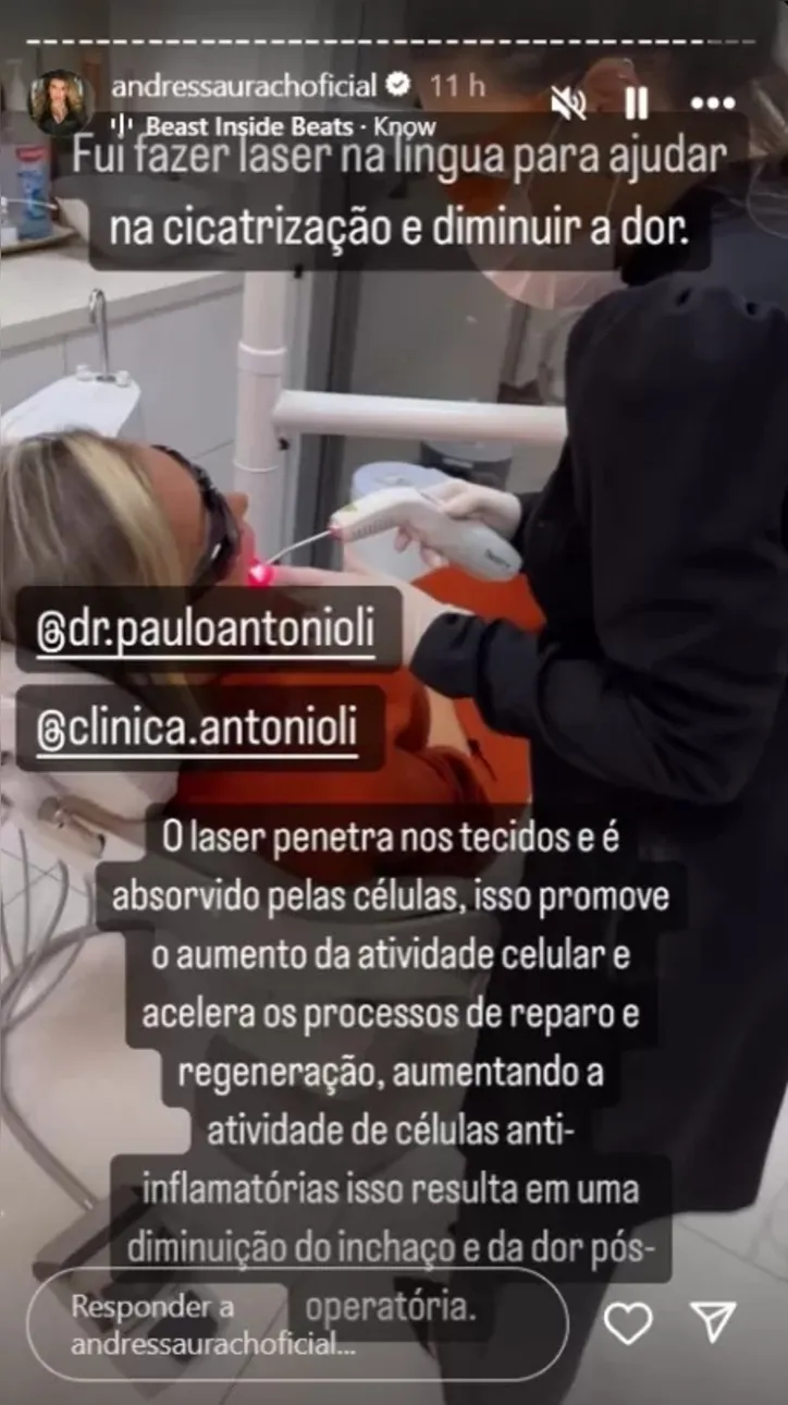 Andressa revelou como funciona o laser na região