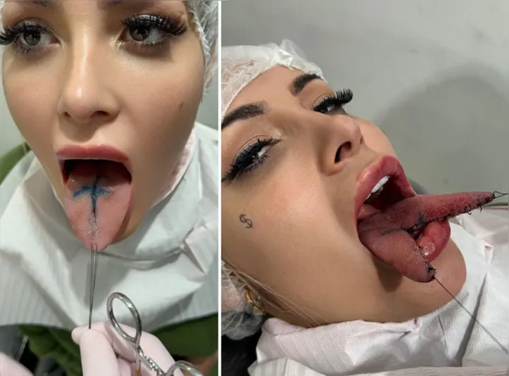 Imagem ilustrativa da imagem VÍDEO: Andressa Urach corta língua ao meio em busca de "maior prazer"