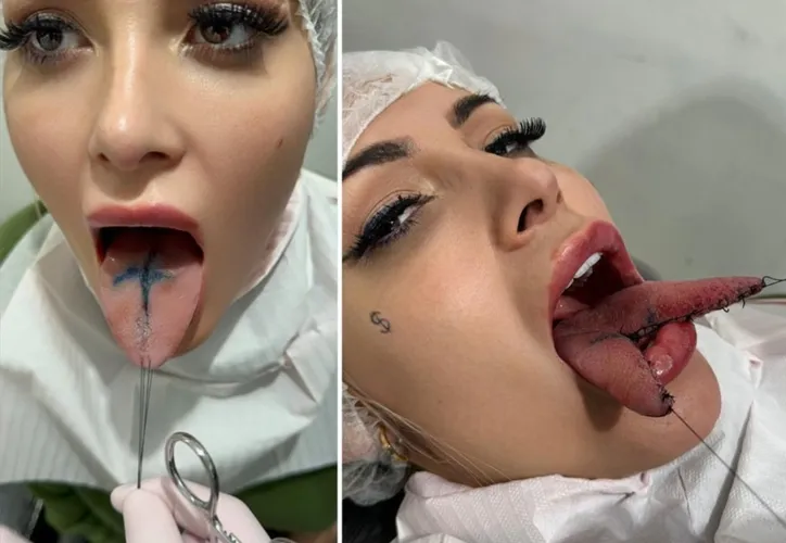 Imagem ilustrativa da imagem VÍDEO: Andressa Urach corta língua ao meio em busca de "maior prazer"