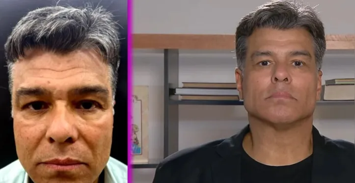 Imagem ilustrativa da imagem Aos 60 anos, Mauricio Mattar faz harmonização facial e surpreende