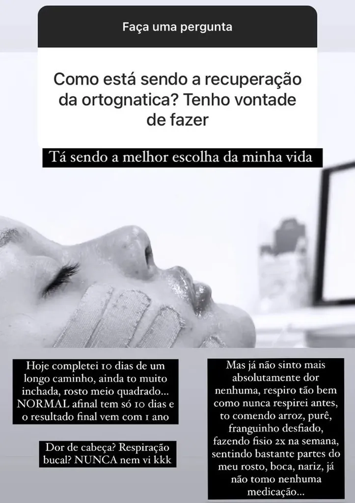 A jovem passou por dois procedimentos estéticos no rosto: uma cirurgia ortognática e uma rinoplastia