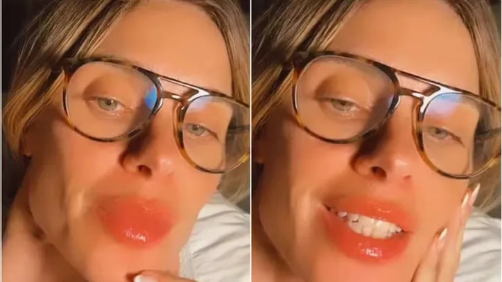 Imagem ilustrativa da imagem Carolina Dieckmann sofre reação alérgica após voo e choca web