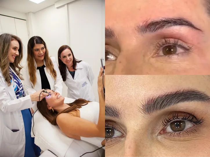 Deborah Secco exibe novo visual após transplante de sobrancelha