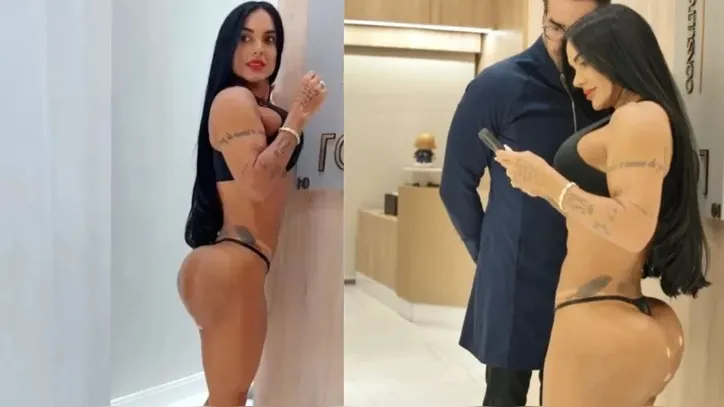 Ex de Tony Salles corrige bumbum após hidrogel: "Tá lindo"