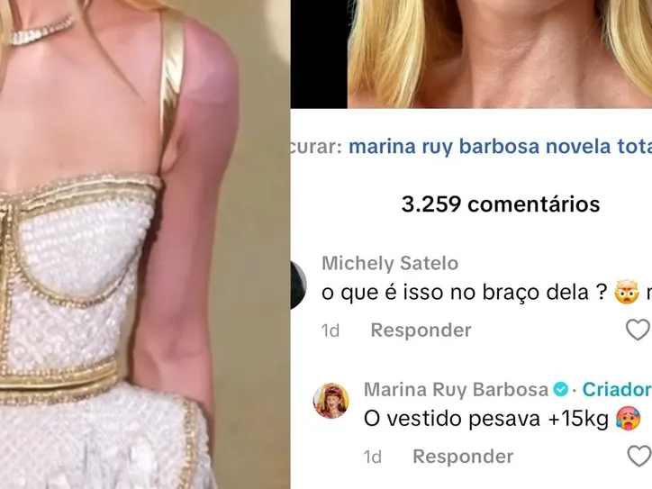 Assustador! Maria Ruy Barbosa explica hematomas em Cannes