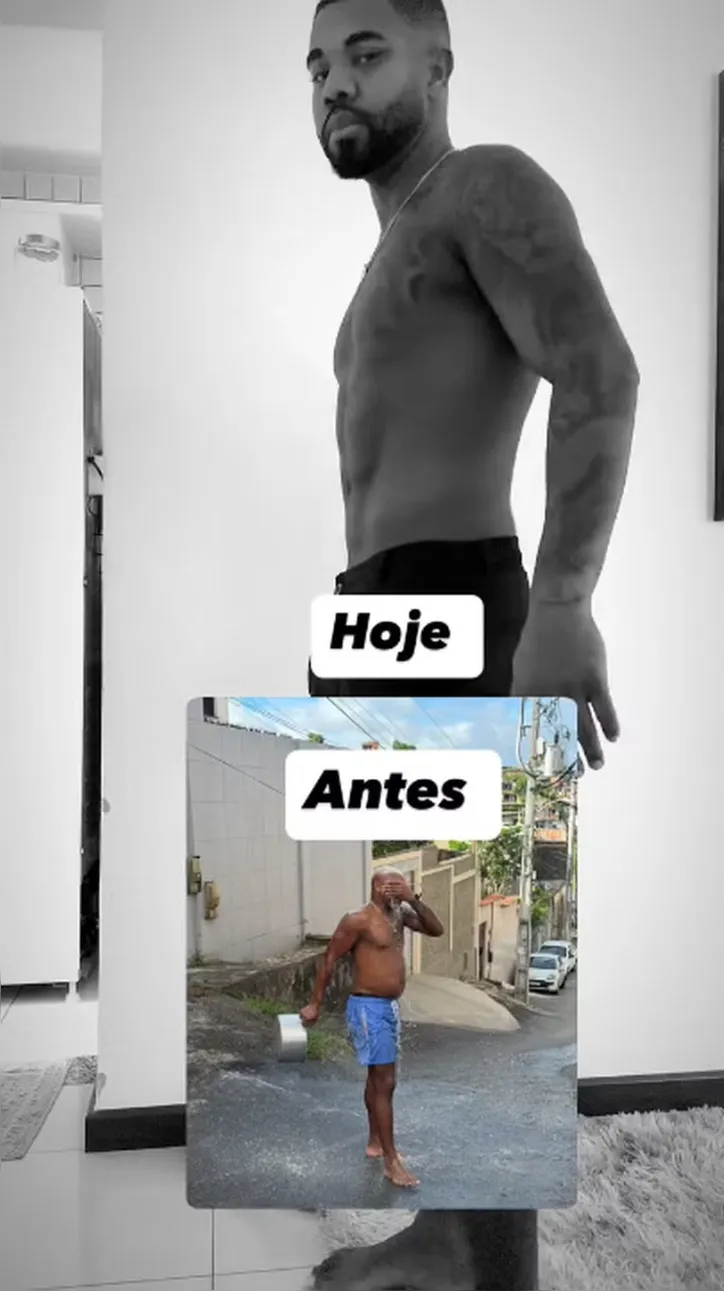 Davi Brito impressiona ao mostrar evolução após procedimento