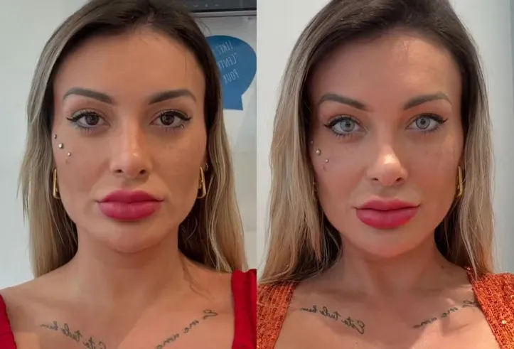Antes e depois de Andressa Urach