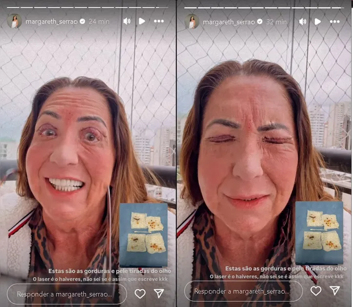 Imagem ilustrativa da imagem Mãe de Virginia Fonseca passa por cirurgia delicada