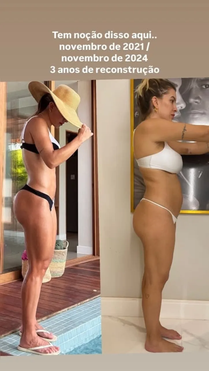 Mostrou tudo! Lore Importa exibe corpo antes e depois da gravidez