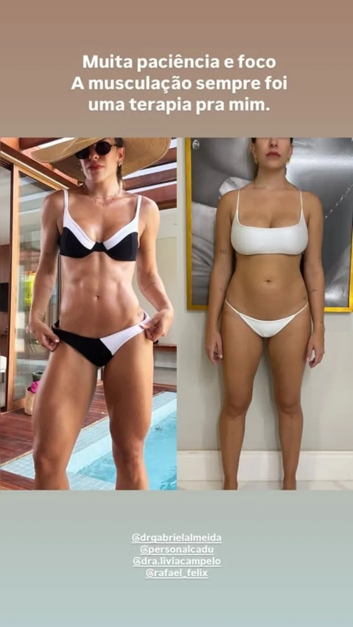 Mostrou tudo! Lore Importa exibe corpo antes e depois da gravidez